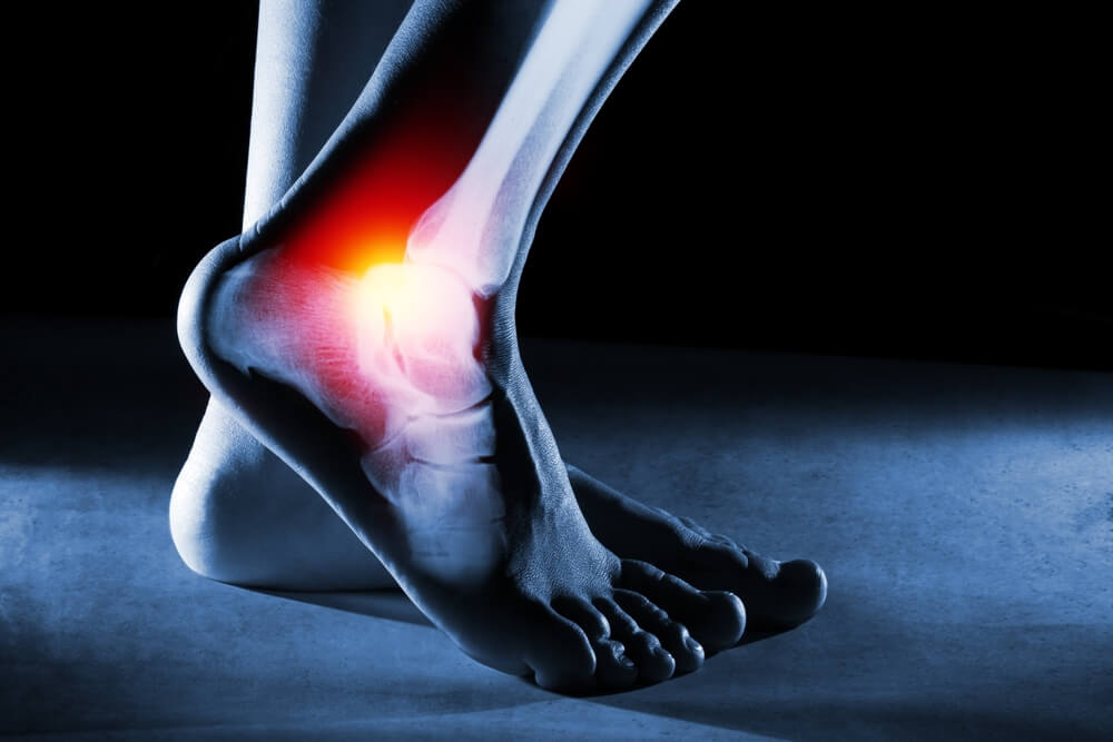 Is Heel Pain A Sign Of Cancer