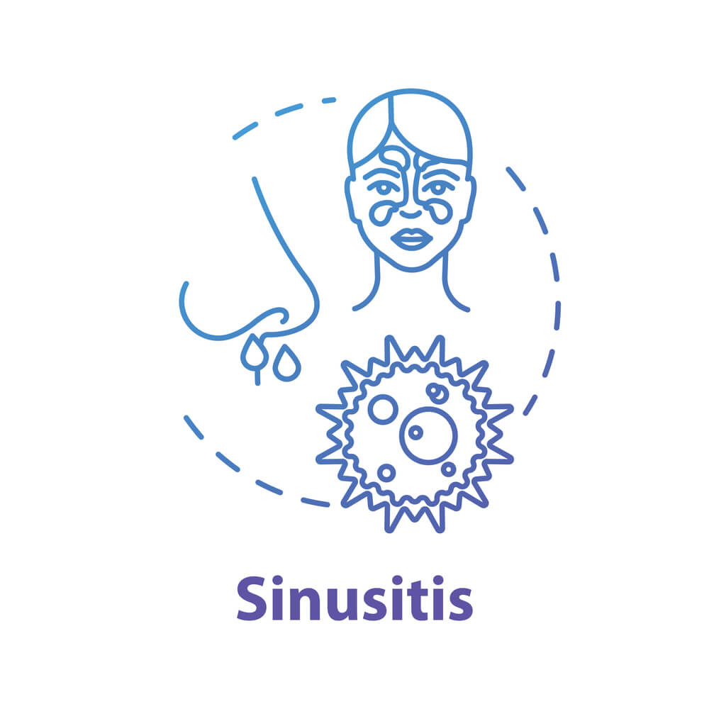 The Causes Of Sinus Infections